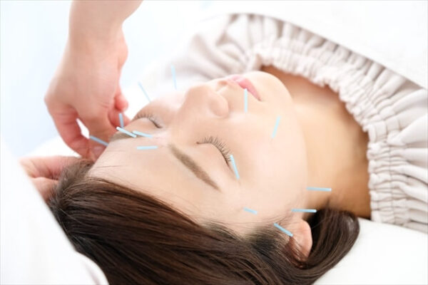 beauty acupuncture s beauty acupuncture s